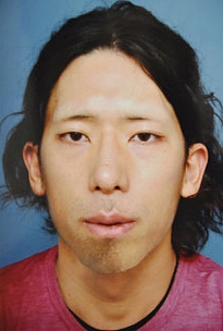 Der Mordverdächtige Tatsuya Ichihashi nach der Gesichtsoperation